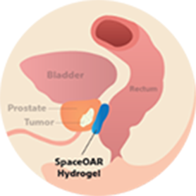 After SpaceOAR diagram