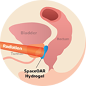 SpaceOAR with Radiation - Diagram